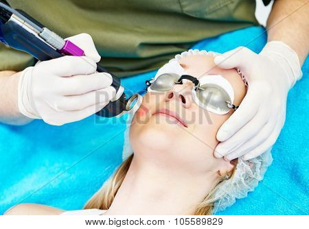 Skincare laser cosmetology procedure of spot papula removal or pigment color change on young woman face