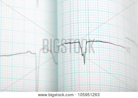 Ecg Graph Medical Background
