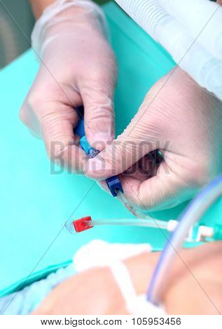 Doctor Puts Catheter To The Patient