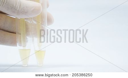 Urine Analysis On White.