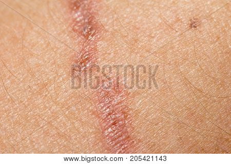 wound on the skin. macro . Photo of an abstract texture