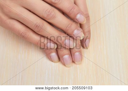 Female hands with not polished nails. Woman hands without gel on nails. Young woman hands before having manicure.