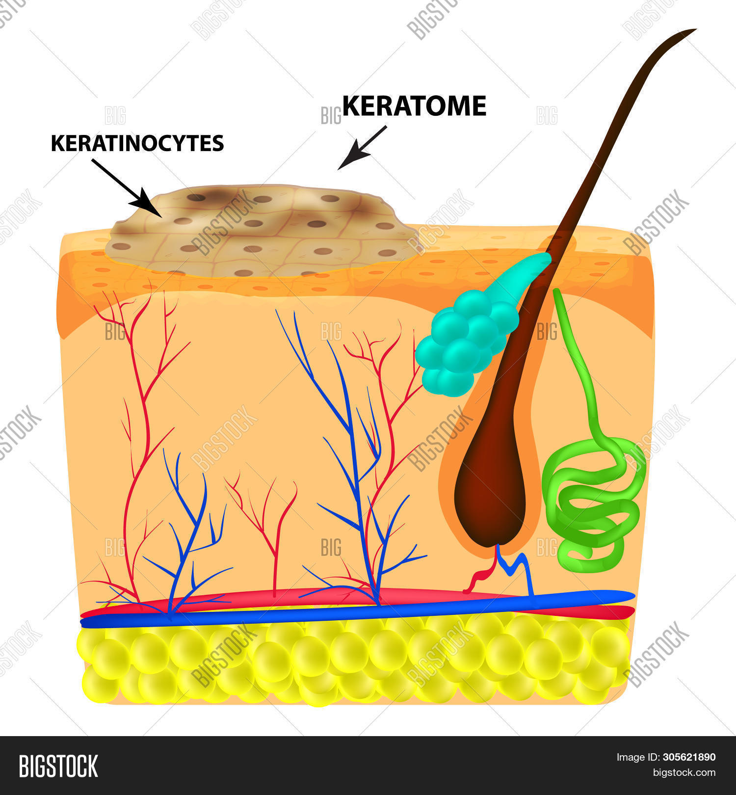 Structure Keratoma. Image & Photo (Free Trial) Bigstock