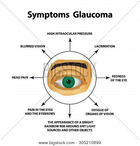 Symptoms Of Glaucoma. World Glaucoma Day. The Anatomical Structure Of The Eye. Infographics. Illustr