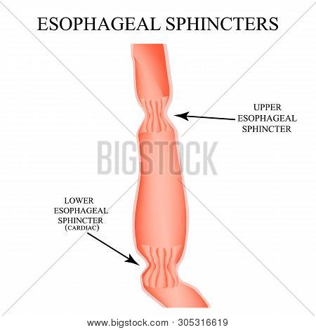 Upper Sphincter Of Esophagus. Lower Cardiac Esophageal Sphincter. Infographics. Illustration On Isol