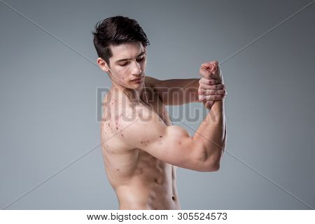 Studio Portrait Young Caucasian Man On Gray Background Posing. Theme Of Puberty, Problem Skin, Teen 