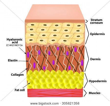 Anatomical Structure Of The Skin. Elastin, Hyaluronic Acid, Collagen. Infographics. Causes Of Wrinkl