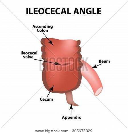 Ileocecal Angle. Ileocecal Valve. Bauginiev S Damper. The Ileum, The Cecum, The Apendix. Colon. Info
