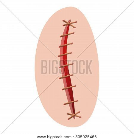 Suture Icon. Cartoon Of Suture Vector Icon For Web Design Isolated On White Background