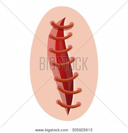 Open Suture Icon. Cartoon Of Open Suture Vector Icon For Web Design Isolated On White Background