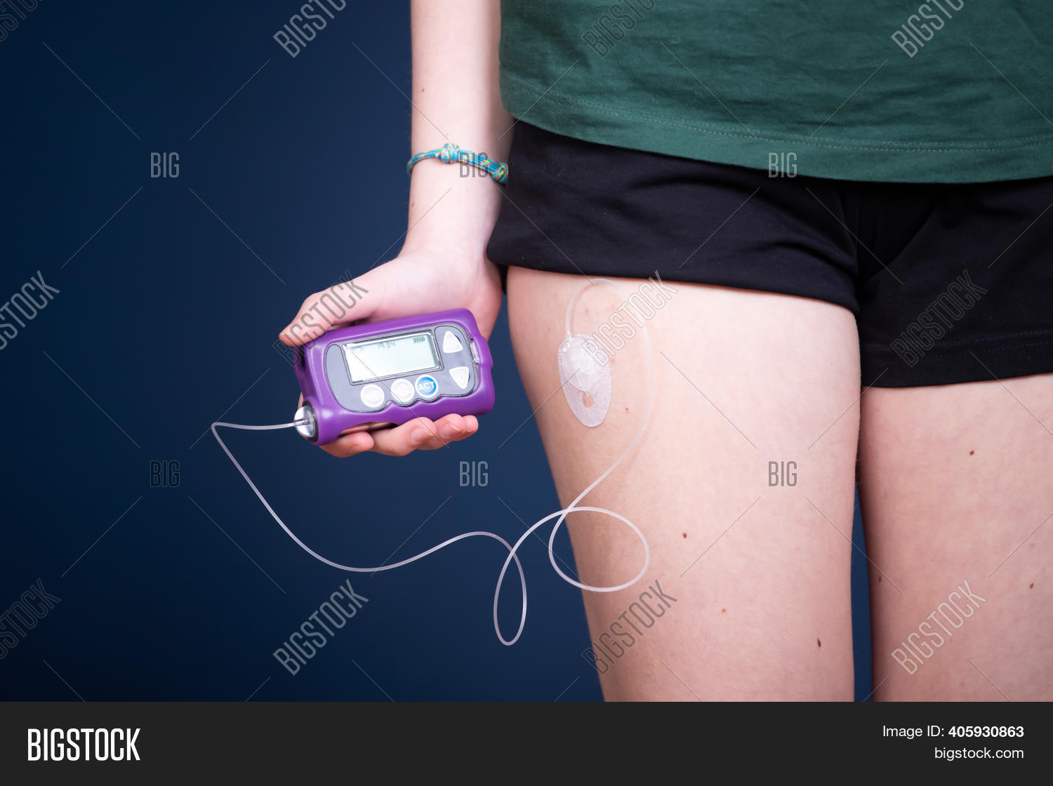 Close View Diabetic Image & Photo (Free Trial) Bigstock