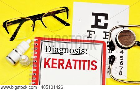 Keratitis Is An Inflammation Of The Cornea Of The Eye. Text Inscription Of The Ophthalmological Diag