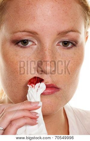 a young woman is bleeding from her nose. stops bleeding nose with a handkerchief.