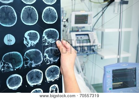 Interpretation Of Tomography Of The Brain In The Icu