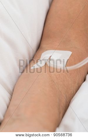 Close-up Of Patient's Hand