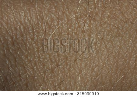 Human Skin Texture For Healthy Background Concept