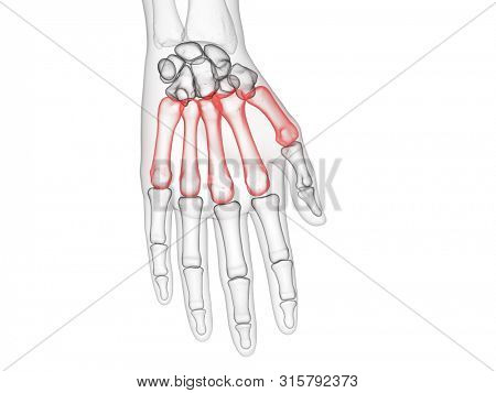 3d rendered medically accurate illustration of the metacarpal bone