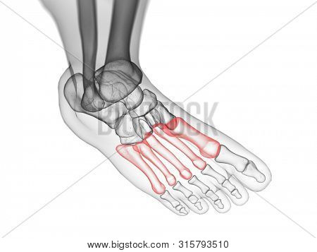 3d rendered medically accurate illustration of the metatarsal bones