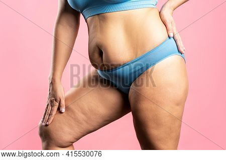 Fat Woman In Blue Underwear On Pink Background, Overweight Female Body