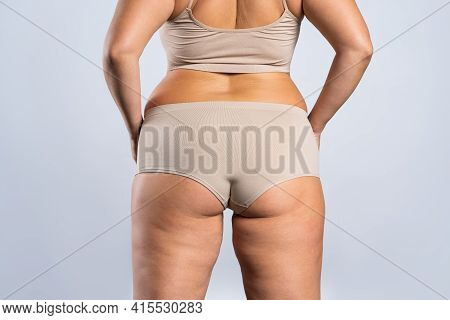 Overweight Woman With Fat Hips And Buttocks, Obesity Female Body On Gray Background