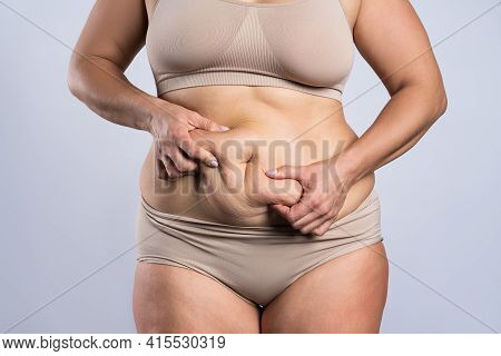 Tummy Tuck, Flabby Skin On A Fat Belly, Plastic Surgery Concept