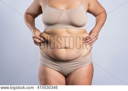 Tummy Tuck, Flabby Skin On A Fat Belly, Plastic Surgery Concept