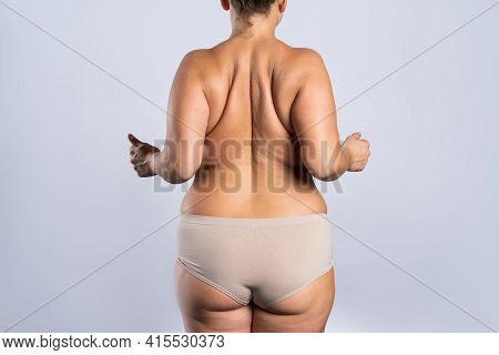 Overweight Woman With Fat Hips And Buttocks, Obesity Female Body On Gray Background