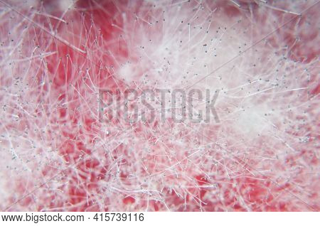 Mold Background Over Red. Macro Shot Of Mold
