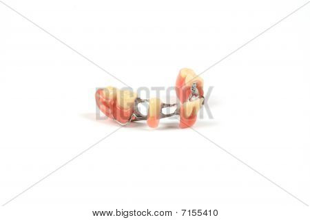 falsche Zähne (Prothese, Krone, Bridge)