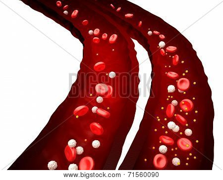 Blood Stream - Normal vs Diabetes - isolated on white