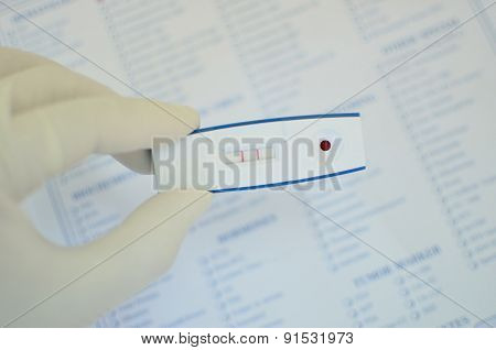 HIV positive