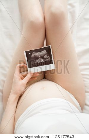 Young Pregnant Woman Looking At Ultrasound Scan