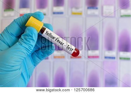 Test tube with blood sample for yellow fever test