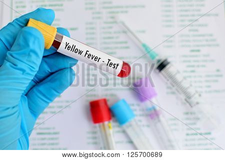 Test tube with blood sample for yellow fever test