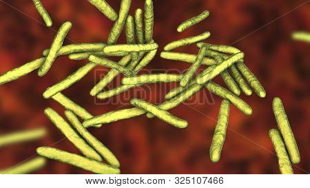 Mycobacterium Leprae Bacteria, The Causative Agent Of Leprosy, 3d Illustration