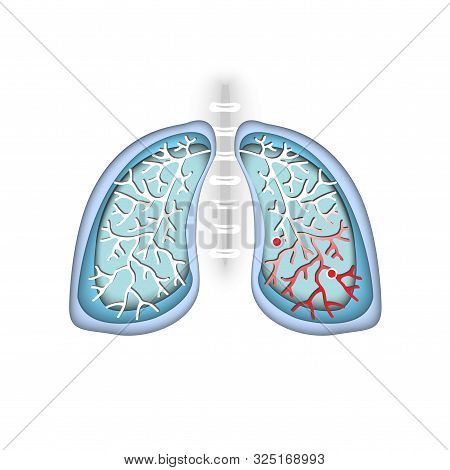 Symbol Lung Disease. Breathing. Respiratory System. Respiratory Disease - Cancer, Asthma, Tuberculos