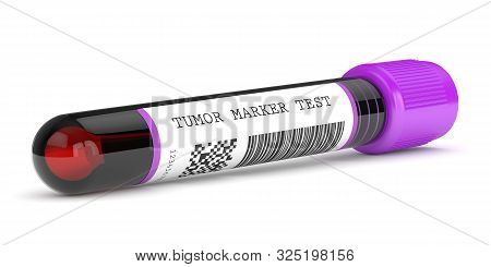3d Render Of  Blood Sample With Tumor Marker Test Over White Background