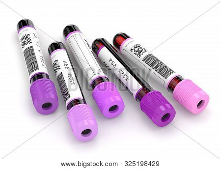 3d Render Of  Blood Samples With Tumor Markers Test Over White Background
