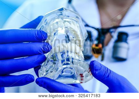Teeth Model Held By Real Dentist With Blue Gloves. Dentist Showing A Jaw Model. Doctor Hands Holding