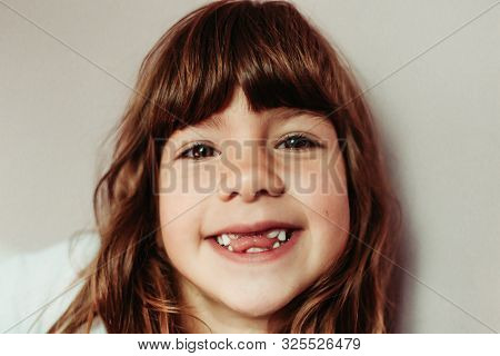 Close-up Portrait Of Girl With No Frontal Teeth. Teeth Eruption, Baby Teeth