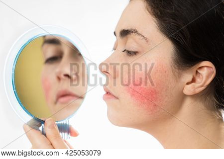 Beautiful Young Woman With Rosacea On Her Cheek Looking At The Mirror. Isolated On A White Backgroun
