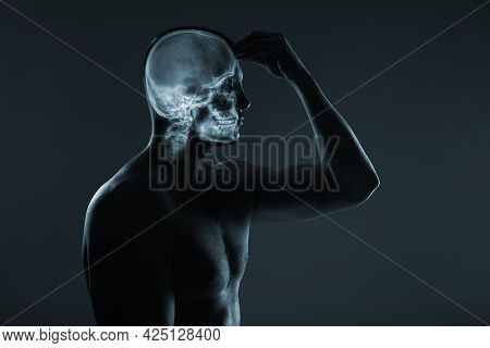 X-ray Of A Man's Head. Medical Examination Of Head Injuries. Others X-ray Images In My Portfolio.