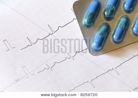 Électrocardiogramme