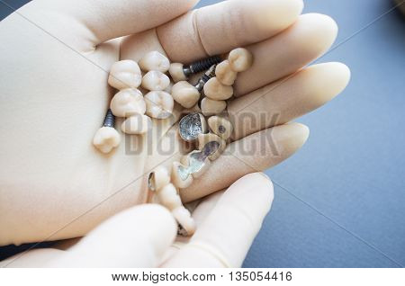 Different kinds of dentures in doctors hands. Doctor moving different dentures in his hand. Top view on dentist hands with dentures and dental crowns
