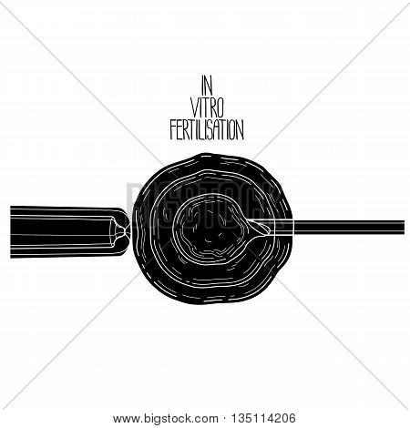 In vitor fertilisation. Artificial insemination. Graphic medical illustration. Vector design isolated on white background