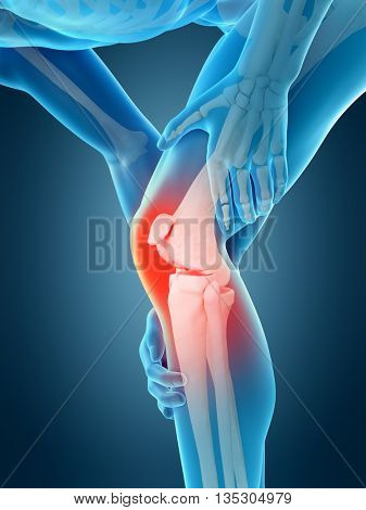 3d rendered, medically accurate 3d illustration of knee pain