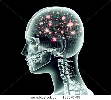 Xray Image Of Human Head With Brain And Electric Pulses