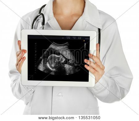 Doctor and digital tablet with ultrasound scan of baby on screen , isolated on white