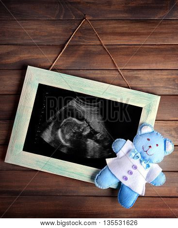 Vintage frame with ultrasound scan of baby on wooden background