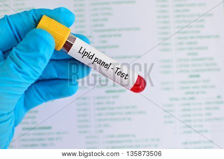 Test tube with blood sample for lipid panel test